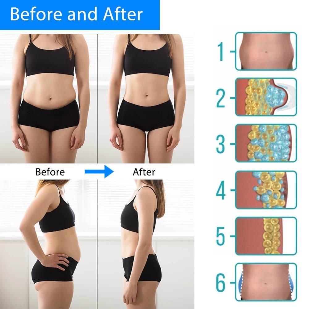 Portable Mini Cryotherapy Fat Freeze Device – Anti-Cellulite, Belly Fat Remover, Body Slimming Cool Machine for Home Use! - One-Sake.com